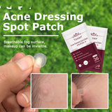 Invisible acne patches demonstrated next to packaging for effective blemish care.