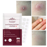 Yoxier invisible acne patches for blemish and pimple care, showing packaging and application on skin.