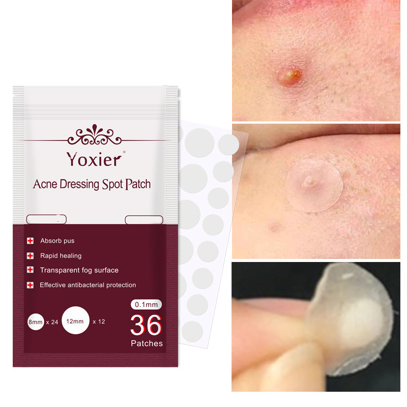 Yoxier invisible acne patches for blemish care with 36 spots for effective antibacterial protection.