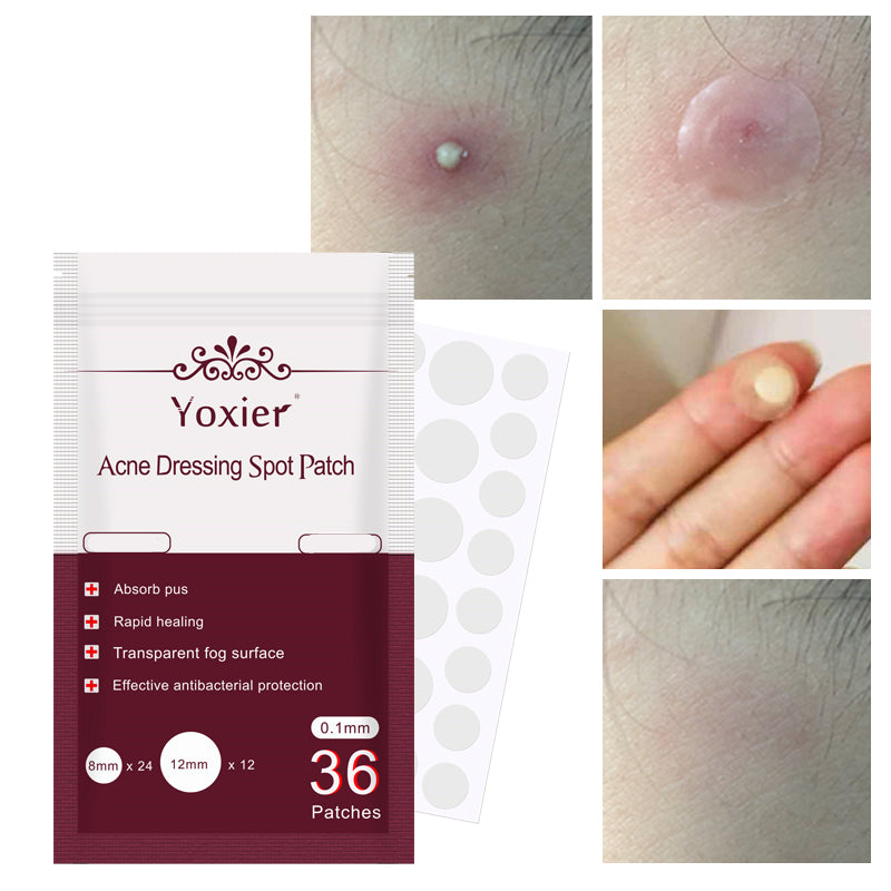 Yoxier acne dressing spot patch set containing 36 invisible acne patches for effective blemish and pimple care.